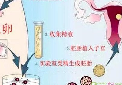 2026唐山试管婴儿费用一览